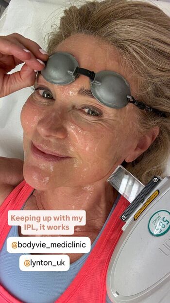 Anthea Turner