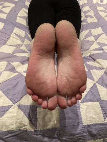 Candytoes