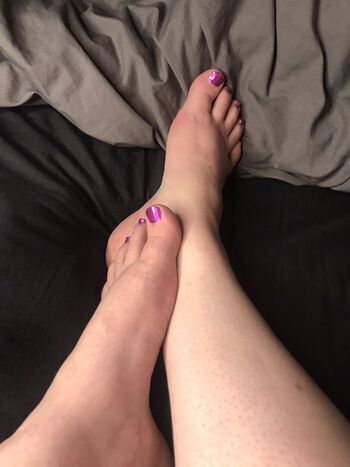 Candytoes