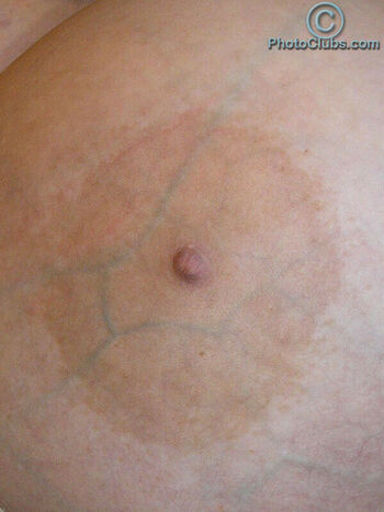 Chelsea Charms