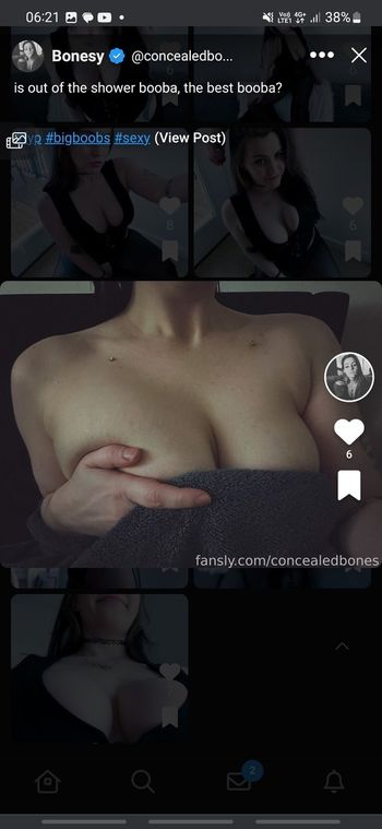 ConcealedBones