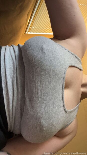 ConcealedBones