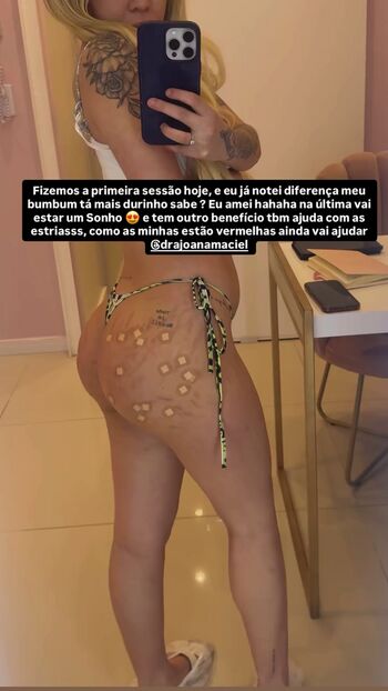 Eutreyce
