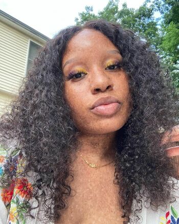 freckledn