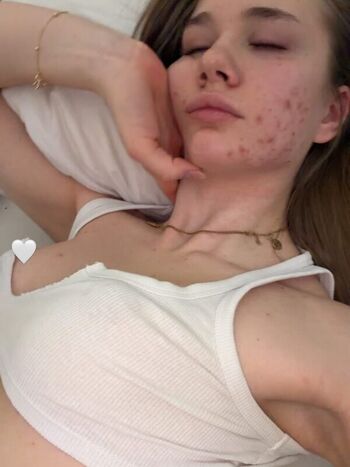 gld.melina