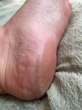 jemsbigfeet