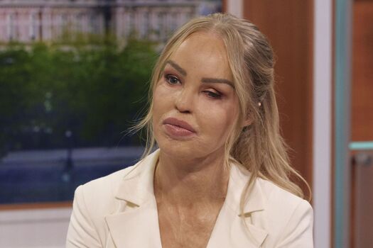Katie Piper