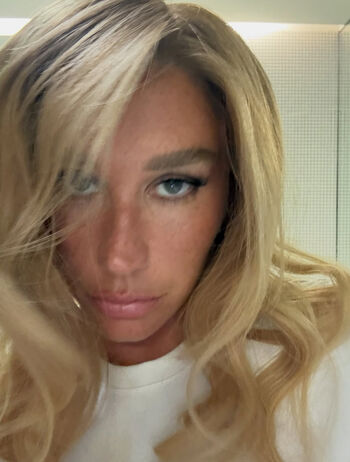 Kesha