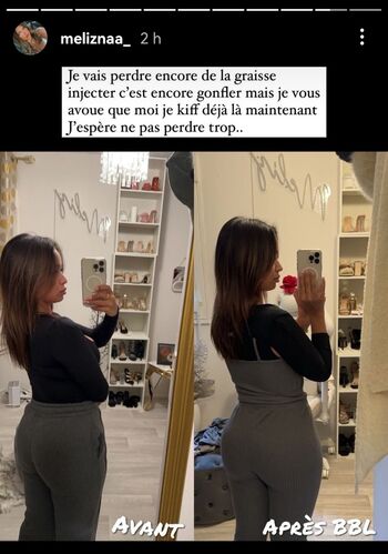Meliznaa_