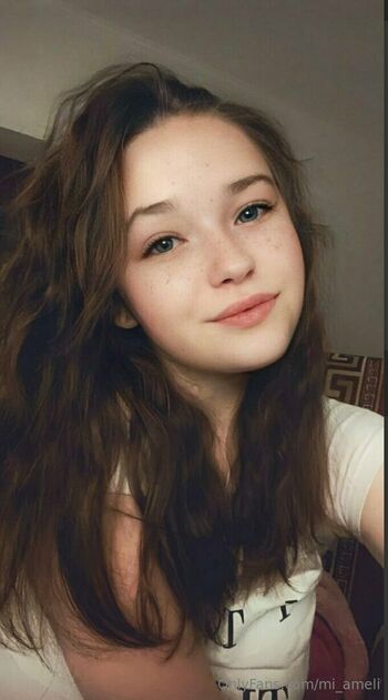 mi_ameli