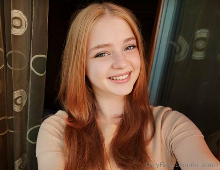 mi_ameli