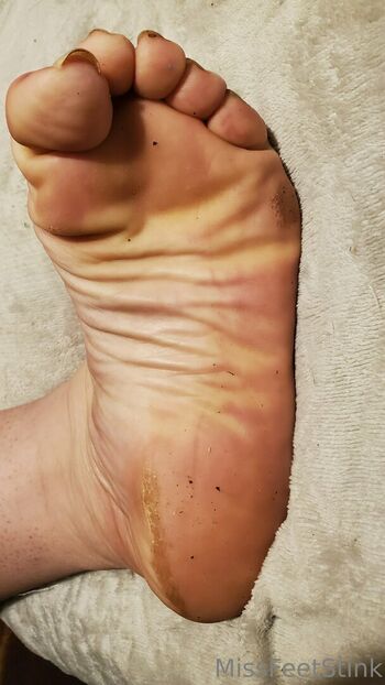 missfeetstink