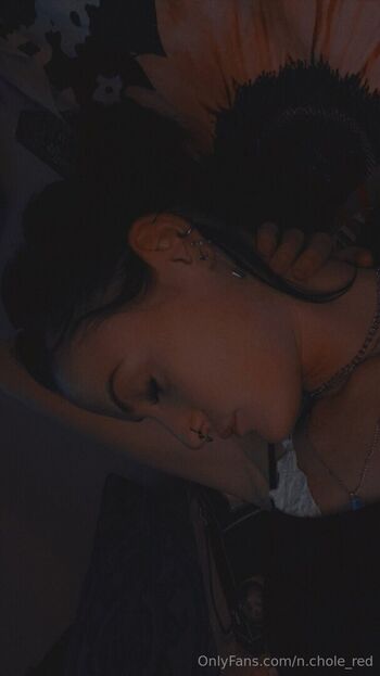 n.chole_red
