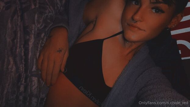 n.chole_red