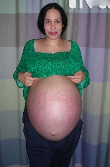 Octomom