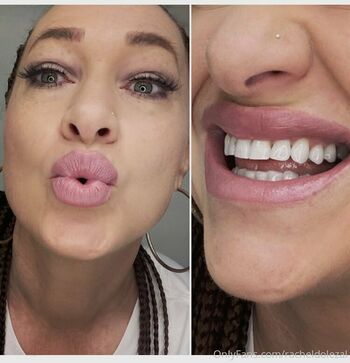 racheldolezal