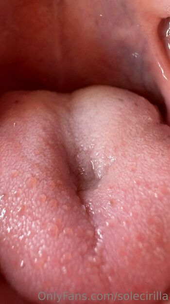 solecirilla