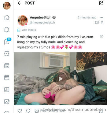theamputeebitch