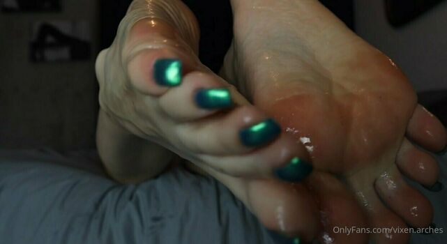 vixen.arches