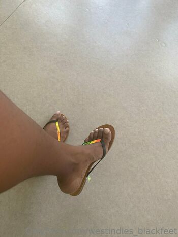 westindies_blackfeet