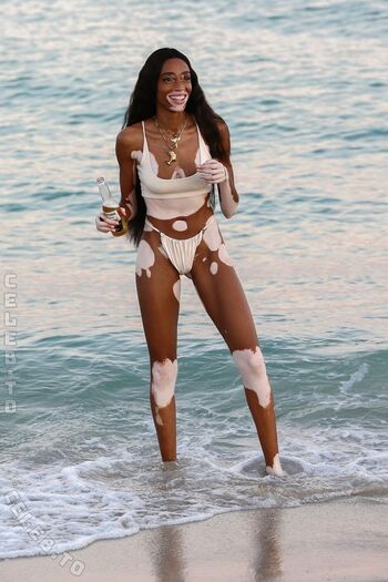 Winnie Harlow