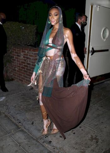 Winnie Harlow
