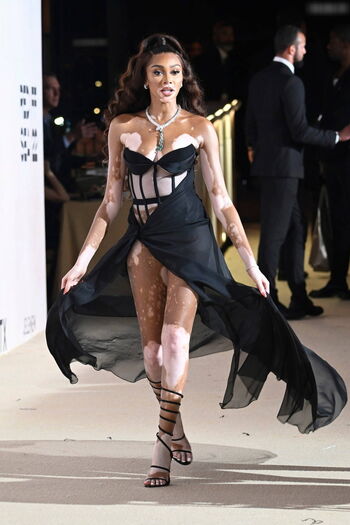 Winnie Harlow