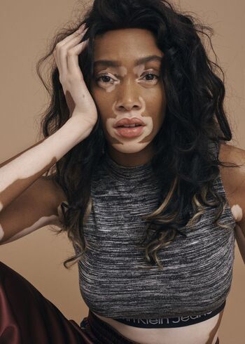 Winnie Harlow