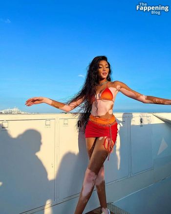 Winnie Harlow