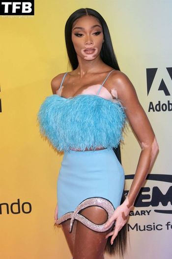 Winnie Harlow