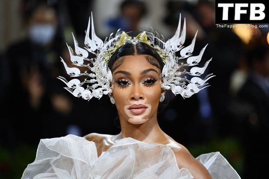 Winnie Harlow