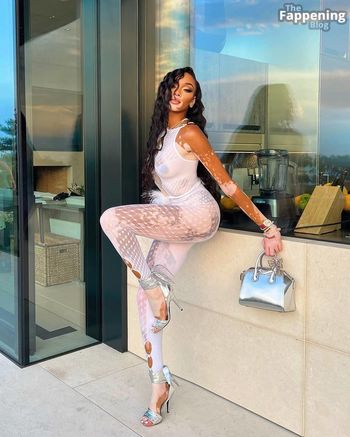 Winnie Harlow
