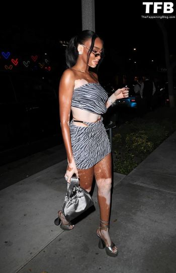 Winnie Harlow