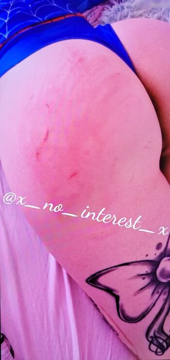 x_no_interest_x